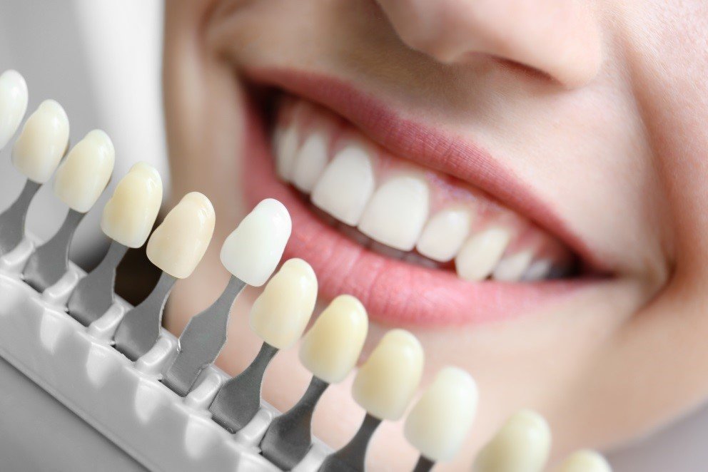 cosmetic dentist near me